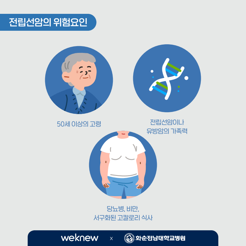 전립선암의 위험요인.  1.50세 이상의 고령, 2.전립선암이나 유방암의 가족력, 3.당뇨병, 비만, 서구화된 고칼로리 식사.